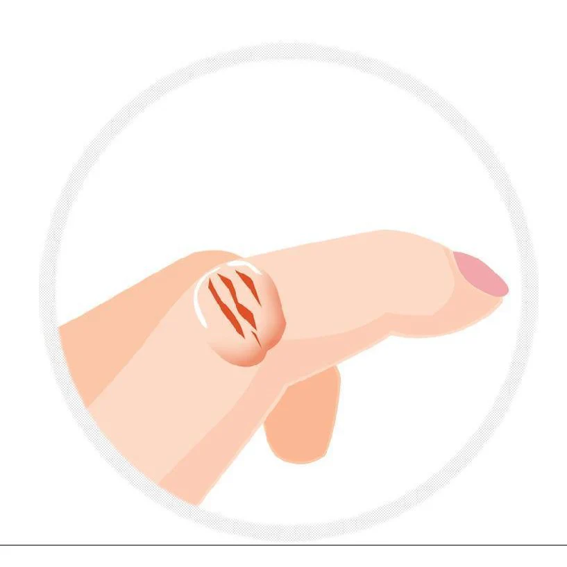 Kobayashi Sakamukea Liquid Bandage Finger Scar Care 10g - Image 5