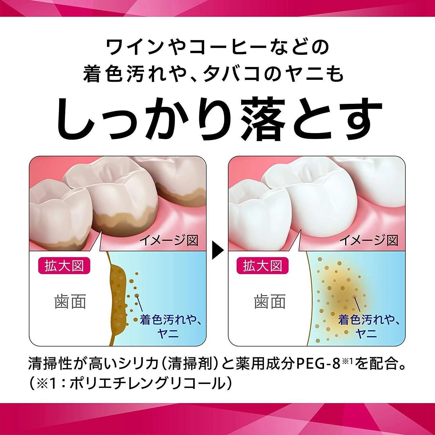 Sunstar Settima Toothpaste Special Care for Gum Health 80g - Image 4